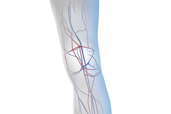 Osteoid Osteoma Ablation treatment in Chandigarh